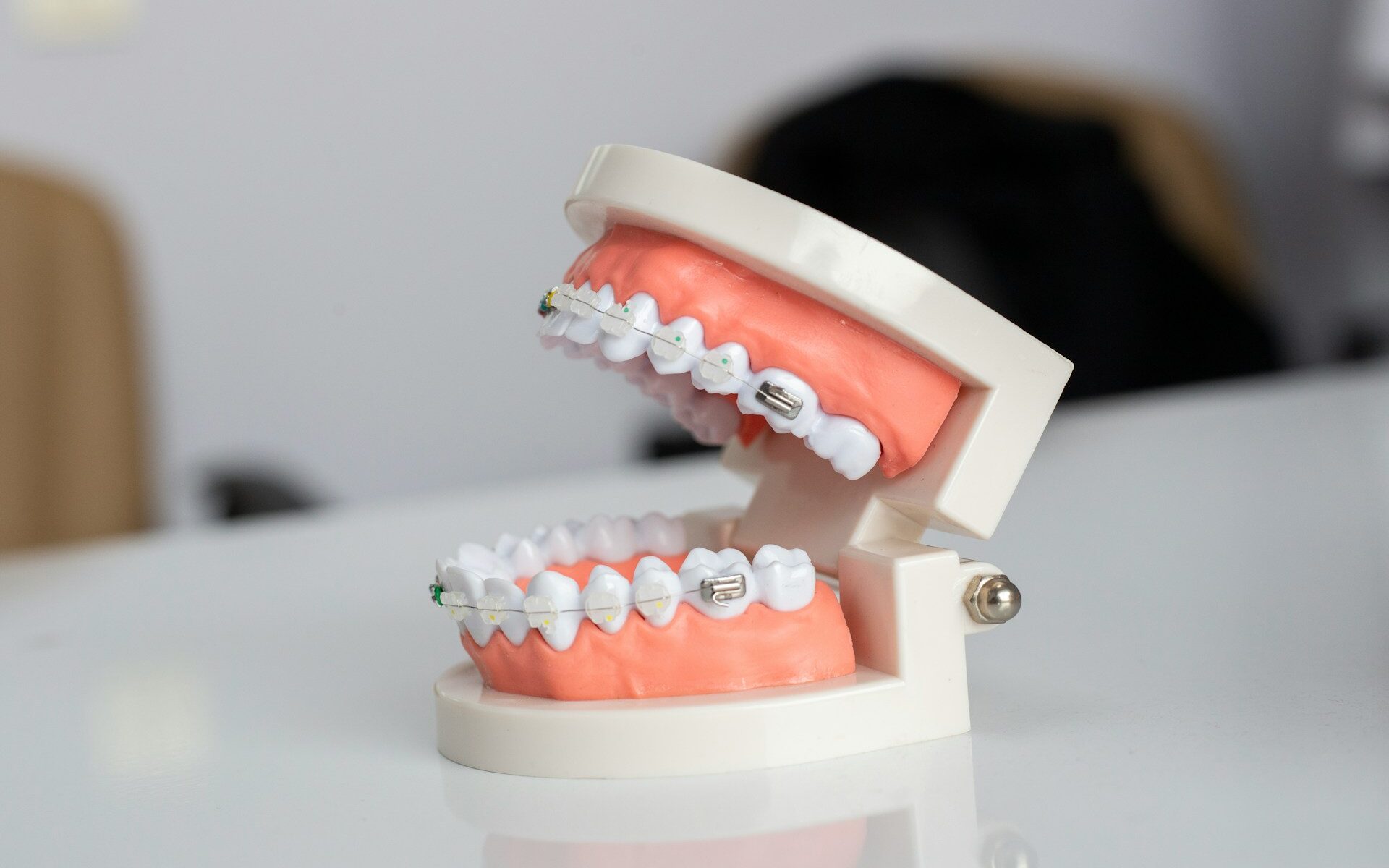 vacature tandarts voor orthodontie