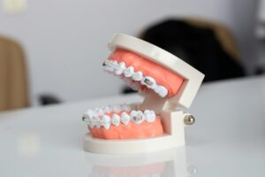 vacature tandarts voor orthodontie